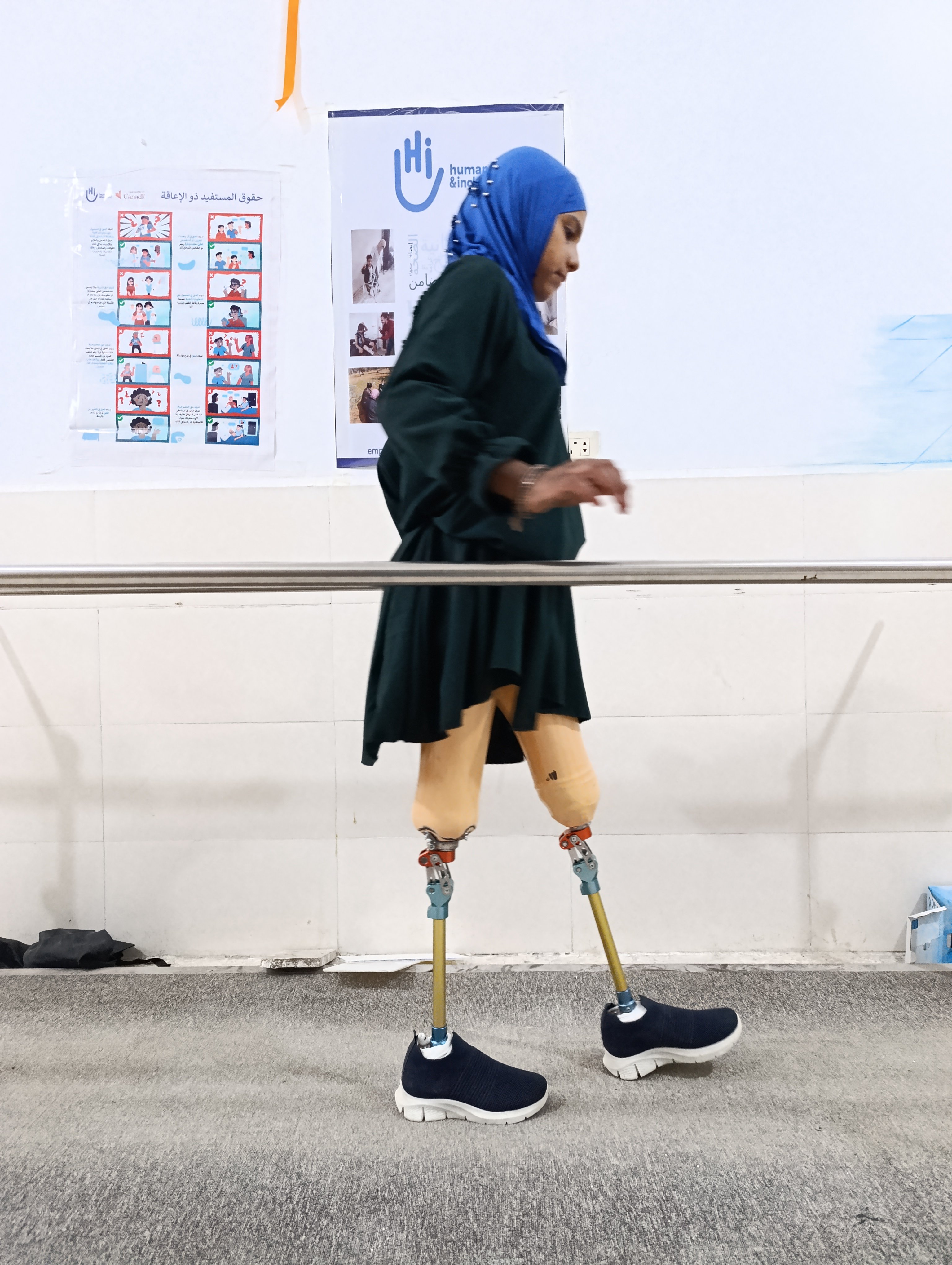 Une jeune fille apprend à marcher avec ses prothèses de jambes dans un centre de réadaptation en Syrie.