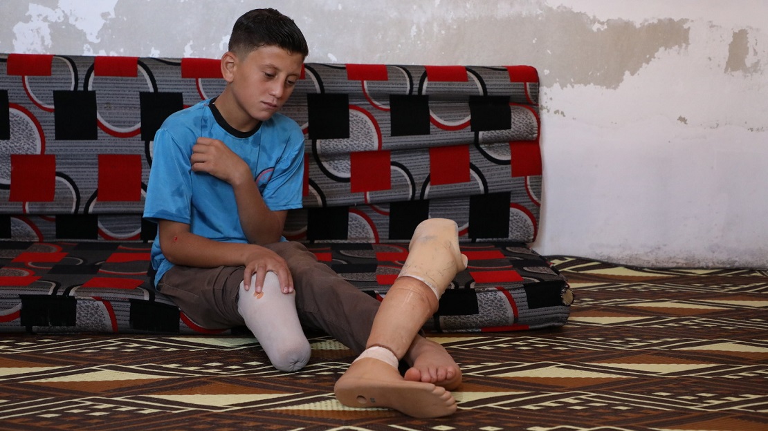 Mohamed est assis sur un canapé chez lui. Il a les jambes dépliées devant lui, et sa prothèse est posée sur son autre jambe. Il regarde sa prothèse avec un air songeur et un visage neutre.