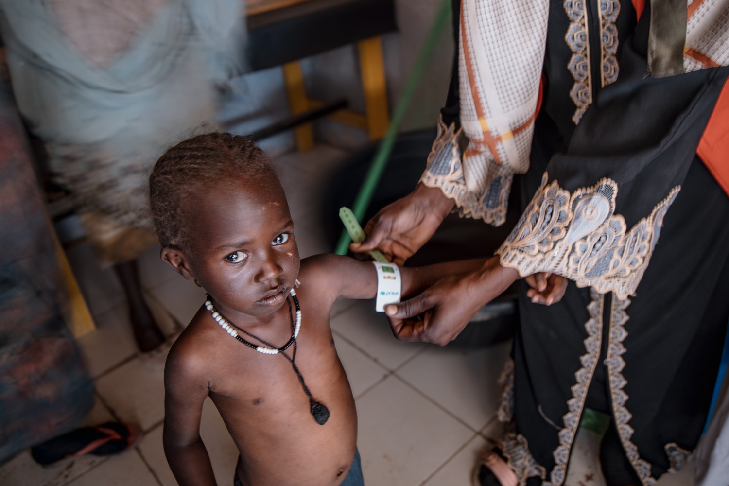 Malnutrition dans le monde : un fléau destructeur pour l’avenir des enfants