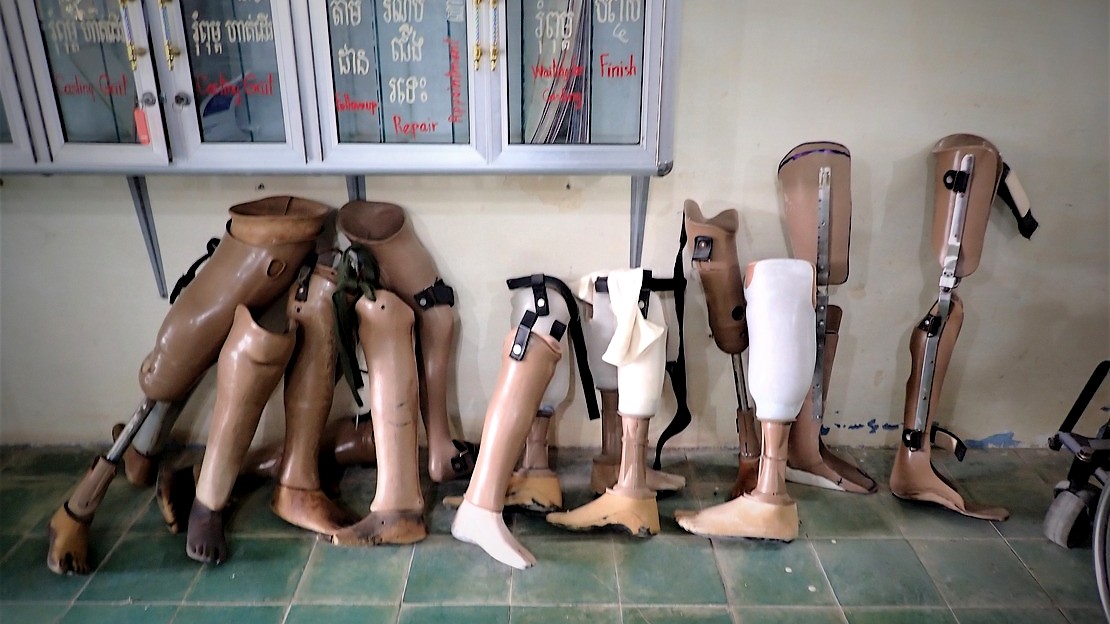 Les appareillages (ici des prothèses) anciens et cassés sont toujours remplacés par des neufs afin de garantir la sécurité, l’efficacité des appareillages utilisés pour les bénéficiaires de Handicap International au Cambodge