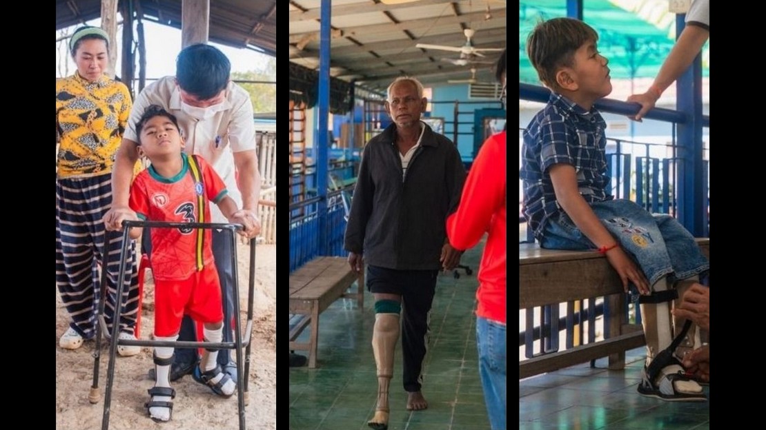 Montage photo de trois Cambodgiens lors de leurs séances de réadaptation à domicile ou au centre de réadaptation de HI à Kampong Cham photo montage. Les trois patients marchent grâce à leur appareils d'assistance : déambulateur, prothèse et orthèse.