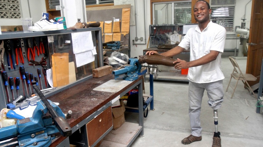 Conception de prothèses et d'orthèses avec le soutien de Handicap International