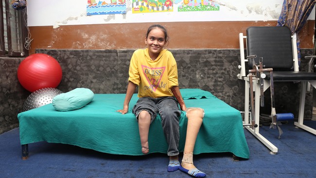 Unisha, jeune fille de 13 ans au Népal, a reçu une prothèse et des soins de réadaptation. © A. Thapa / HI