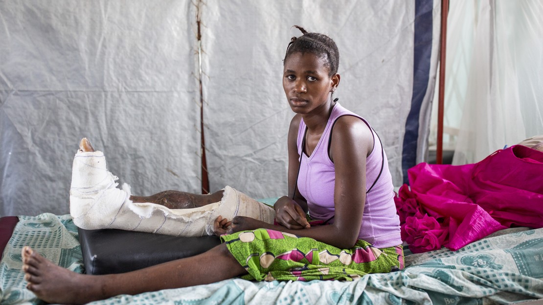 Kanyere Mwamini, fusillée chez elle, est soignée à l'hôpital de Rutshuru, au Nord Kivu en RDC. Elle bénéficie de séances de réadaptation et de soutien psychosocial avec Handicap International.