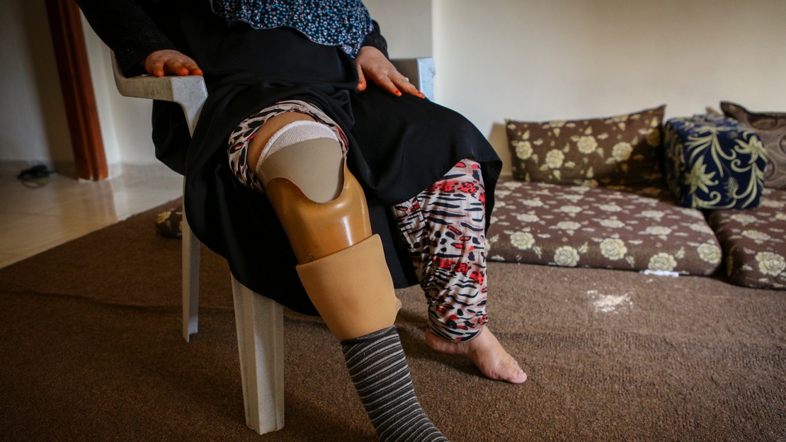 Aujourd'hui réfugiée en Jordanie, Myriam a perdu sa jambe en Syrie à cause d'un bombardement qui lui a aussi pris son fils.