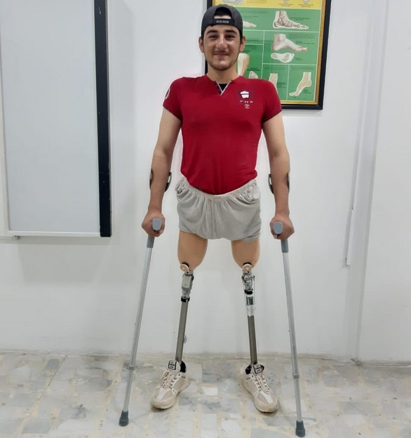 Ismail est heureux d’avoir reçu ses nouvelles prothèses grâce au soutien de Handicap International.