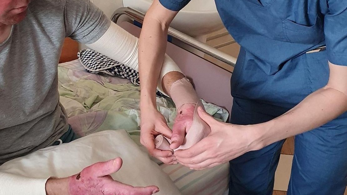 Ivan, kinésithérapeute de Handicap International, aide Vladimir à faire des exercices de rééducation pour ses brûlures après une explosion survenue en Ukraine.
