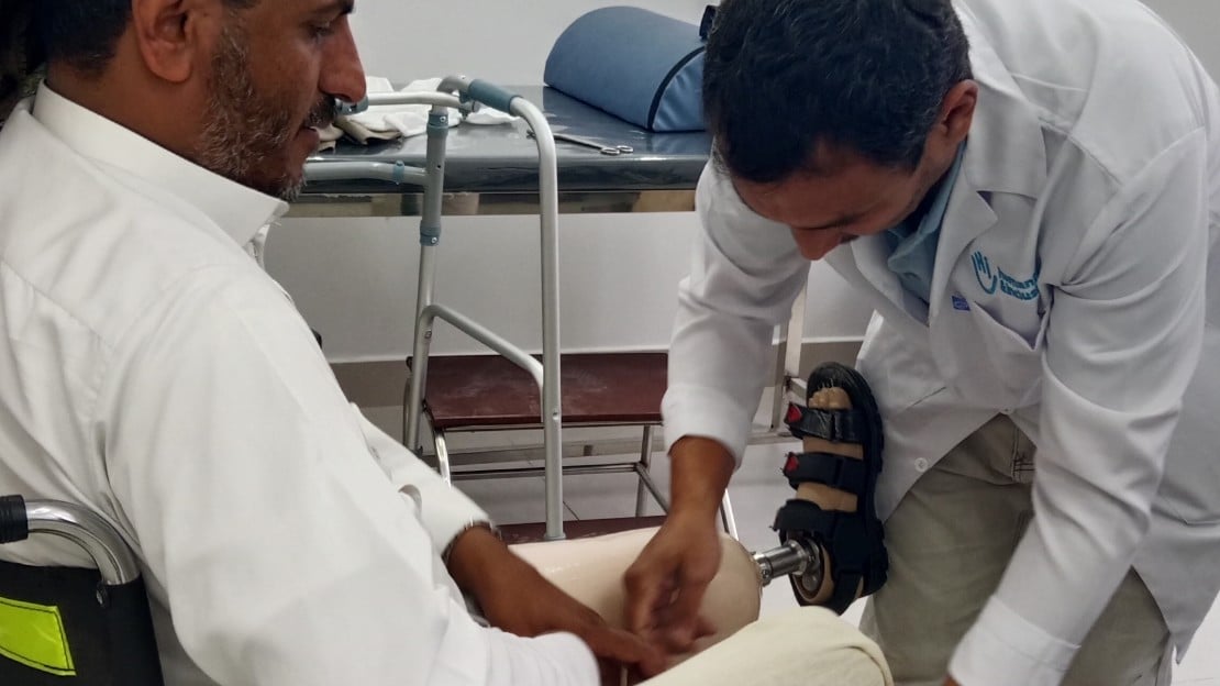 Amputé des deux jambes, Mohammed marche à nouveau avec des prothèses