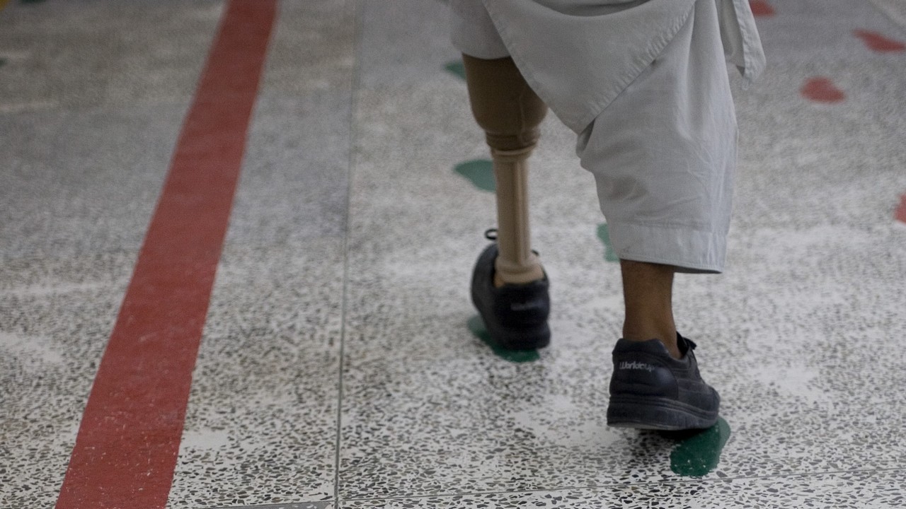 Handicap International est présente en Afghanistan depuis de nombreuses années et fournit aux victimes de mines des prothèses et des séances de kinésithérapie.