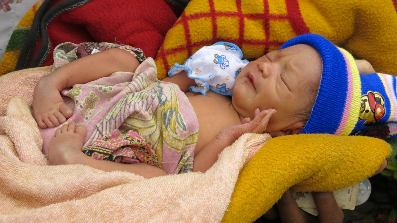 Handicap International intervient sur la thématique du pied bot dans une quinzaine de pays, notamment au Cambodge.