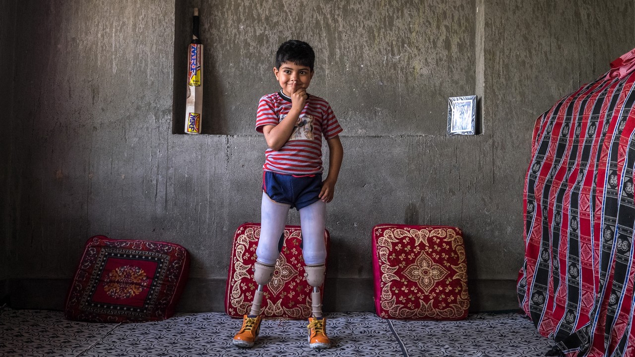 Fayaz, 5 ans, victime d'un reste explosif de guerre quand il avait 3 ans. Amputé des deux jambes. Il a reçu des prothèses avec le soutien de Handicap International et bénéficie de séances de réadaptation