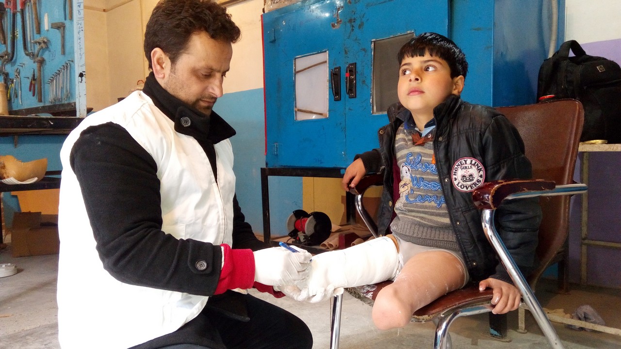 Fayaz a perdu ses deux jambes à cause d'un reste explosif de guerre au Cachemire quand il avait 3 ans. Il a suivi des séances de réadaptation avec Handicap International. Il a reçu deux prothèses et a réappris à marcher.