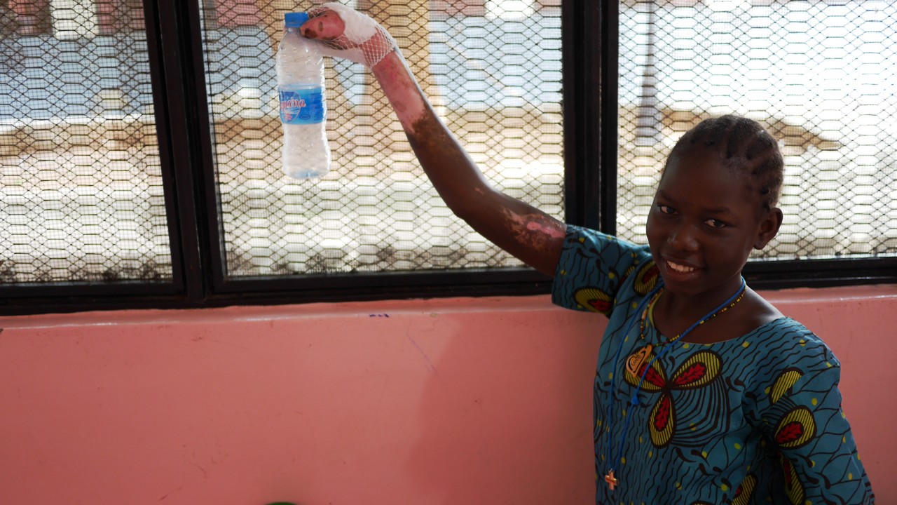 Mary, l'une des victimes de l'explosion d'un camion-cterne en septembre 2015, a reçu un traitement de kinésithérapie de l'équipe de Handicap International à   Juba. Elle est aujourd'hui capable de refaire les gestes de la vie quotidienne.