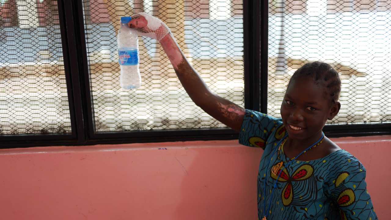 Handicap International est présente aux côtés des survivants de l’explosion d’un camion-citerne au Soudan du Sud.